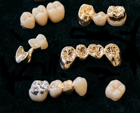 Zahngold wie Kronen und Brücken auf Samt